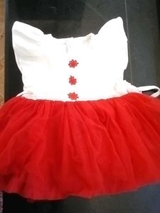 Adorable Baby Dress Compo Offer -3