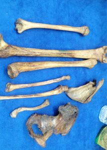 Anatomical Bone Set