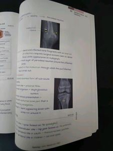 Marrow  Radiology Notes For NEET PG