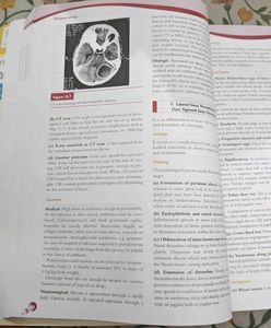 ENT Diseases Textbook, 5th Edition