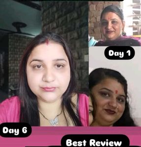 Skin Whitening Night Cream