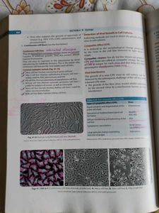 Essentials of Medical Microbiology