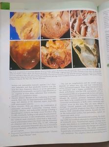 Robbins Basic Pathology