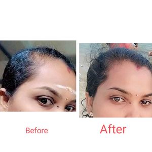 MPR Hair Oil