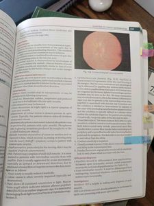 ophthalmology ak khurana 9th edition textbook