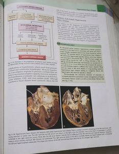 Robbins Basic Pathology