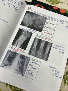 DAMS DVT 2025 NEET PG Revision Book
