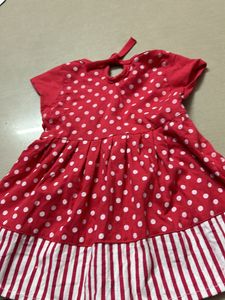 Baby Frock