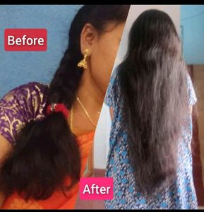 Assure Hair Oil And Shampo