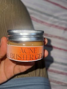 Acne Buster Cream