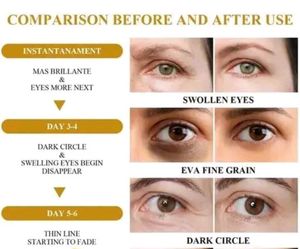 24k gold eye patches for dark circles