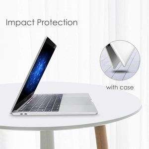 Dyazo 13.3 Inch Macbook Case | Cover | Hard Shell