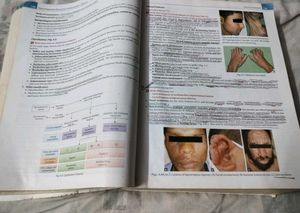 Baloor 2nd Edition Medicine