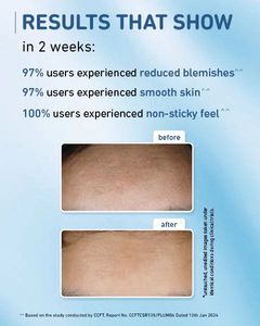 10% Niacinamide Face Serum with Rice Water - 15ml.