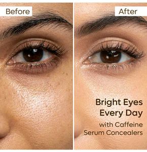 MCaffeine Serum Concealer