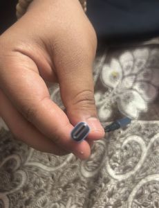 Mi Earphones And Zebronics Splitter For Iphone
