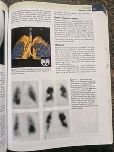 Hutchison's Clinical Methods 24th Edition
