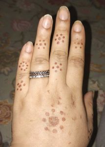 Antique Look Rings From Forever 21