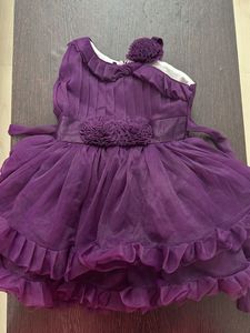 Baby Frock