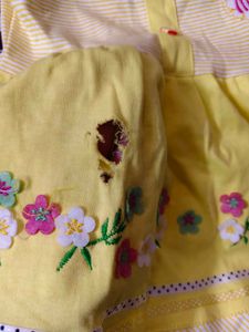 Baby Frock