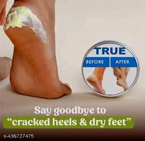 Foot Crack Healing Cream | See Reviews Before Buy