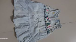 baby frock