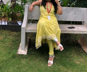 Yellow Lace Dress with Scalloped Hem