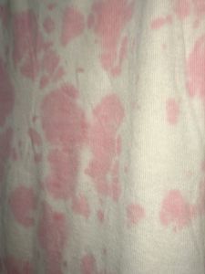 Pink Tie-Dye Dress