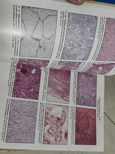 Textbook of Pathology