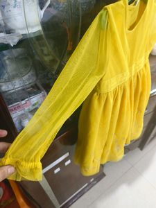 Yellow 🟡 Frock 💛