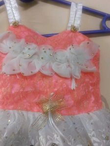 baby frock