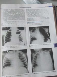 Ghai Essential Pediatrics 9th Edition