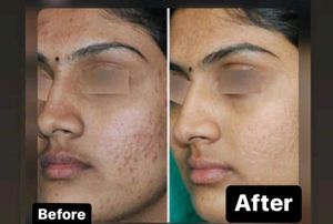 Skin Whitening Night Cream