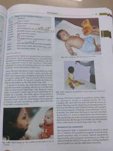 Op Ghai Textbook Of Paediatrics