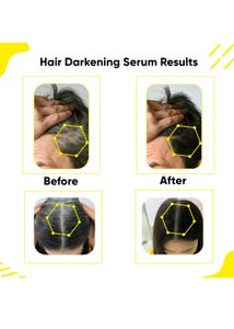 Masofta Anti Grey Hair Darkening Serum