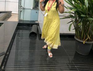Yellow Lace Dress with Scalloped Hem