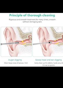 Ear Wax Removal Tool