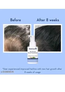 WishCare Hair Growth Serum Concentrate