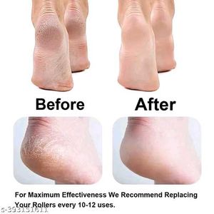 Foot Crack Remoer