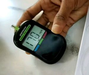 OneTouch Select Plus Simple Blood Glucose Monitor.