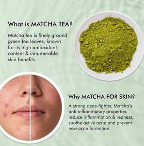 Anti Acne Pads
