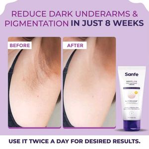 Sanfe Spotlite Body Lightening Cream