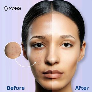 MARS Oil Blotter Gel Compact