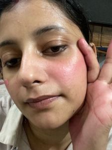 Lip And Cheeks Tint