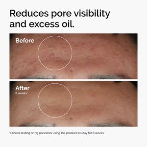 The Ordinary Salicylic Acid 2% Solution