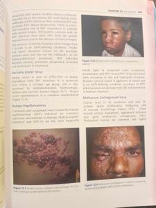 IADVL's Concise Textbook of Dermatology