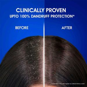 Head&amp;Shoulder Shampoo Anti Dandruff 1 Litre