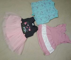 Cute Baby Girl Dress Bundle
