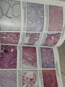 Textbook of Pathology