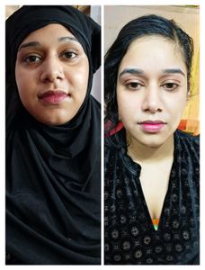 Pigmentation Cream Kit